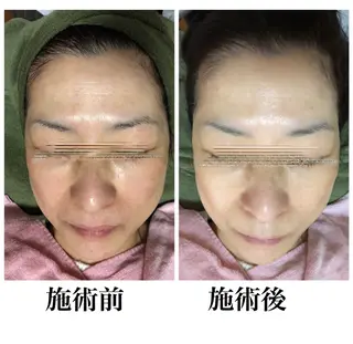 private salon Dea_maris シュガーリング&パーソナルボディケア所属・シミ改善・韓国肌管理 ボディメイク痩身のその他イメージ