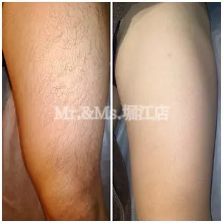 Mr.&Ms.脱毛 YUNAのエステ・リラクイメージ