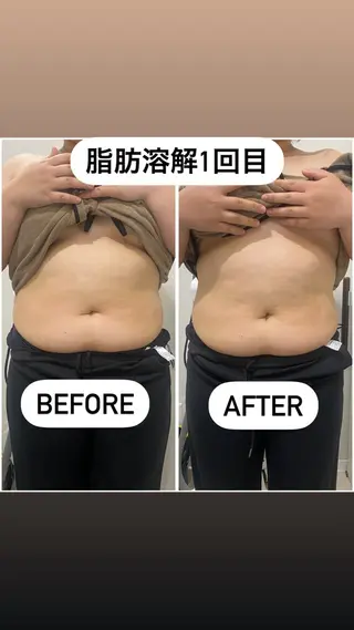 毛穴洗浄・痩身・脱毛 /アルカンジュのエステ・リラクイメージ