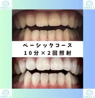 ネイル メンズ キッズ セルフホワイトニングサロンSHELL所属・セルフホワイニング サロンSHELL木場のエステ・リラクイメージ