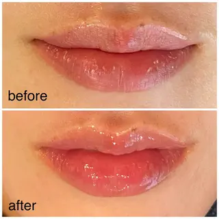 leolo武蔵浦和 肌質改善＆脱毛のエステ・リラクイメージ