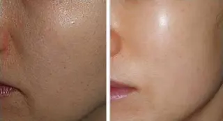 BISIN MEDICAL salon所属・BISIN MEDICALのエステ・リラクイメージ