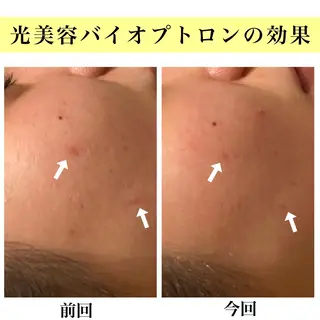 Bellesthe (ベルエステ)のエステ・リラクイメージ