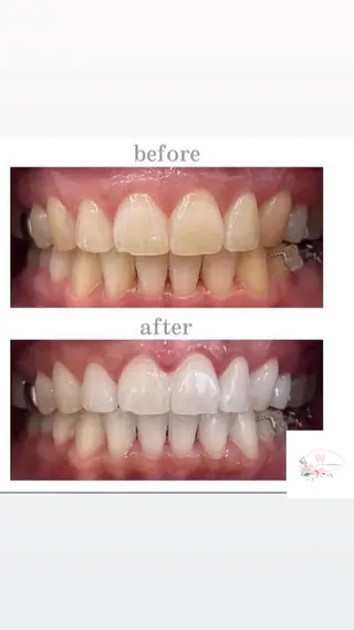 ホワイトニングショップ本厚木所属・ホワイトニング ショップ本厚木のその他イメージ