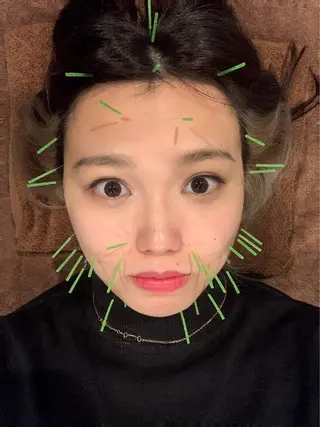 美容鍼灸サロン LOMIHARIのエステ・リラクイメージ