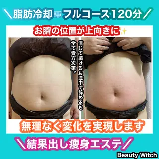 痩身/脱毛/ネイル HARUKAのエステ・リラクイメージ