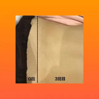 美肌脱毛専門サロン Dione栄店のエステ・リラクイメージ