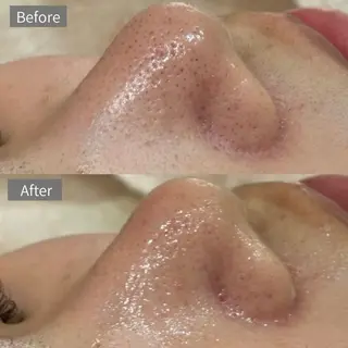 Suu.千種/今池 毛穴洗浄/韓国肌管理のエステ・リラクイメージ