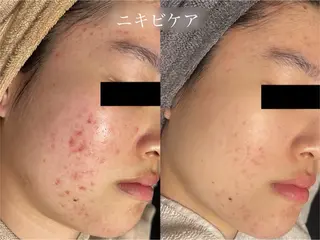 rejena 山口のエステ・リラクイメージ