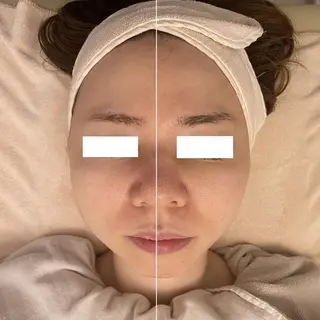 ✨美肌水光✨ アトリエリュバンのエステ・リラクイメージ