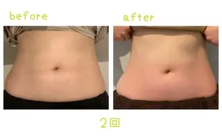 癒し腸もみサロン シャユーム　ゆきなのエステ・リラクイメージ