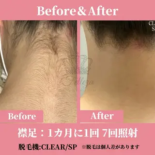 メンズ キッズ 有人型セルフサロン 脱毛/痩身/美顔のその他イメージ