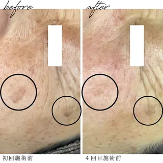 最新シミケアLily de pearlのエステ・リラクイメージ