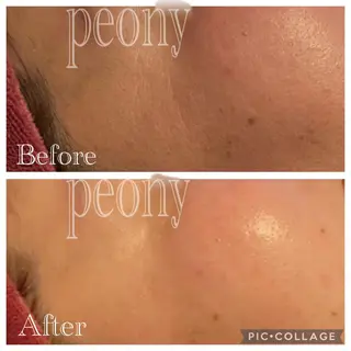 デトックス美容専門サロンpeony所属・デトックス美容専門 サロンpeonyのエステ・リラクイメージ