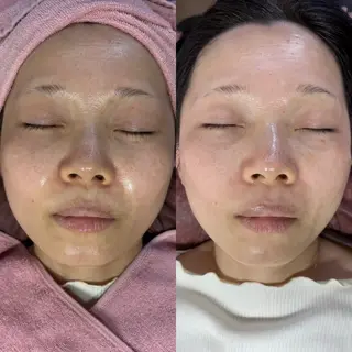 siro スタッフのエステ・リラクイメージ