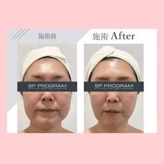 Palum Airiのエステ・リラクイメージ