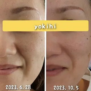 自然由来スキンケア/ 肌質改善/まつパのエステ・リラクイメージ