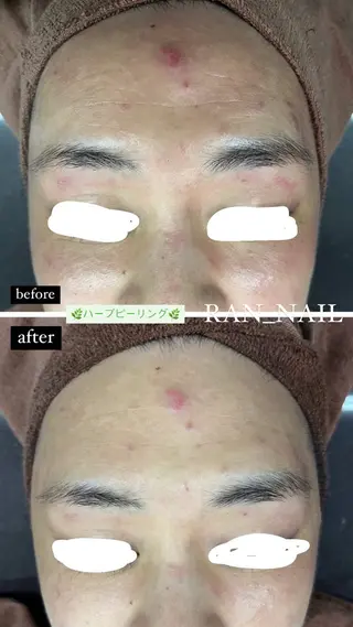 志免町 フェイスシャルエステのエステ・リラクイメージ