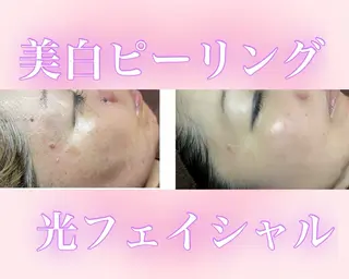 ココルアナ橋本店所属・ココルアナ 橋本店のエステ・リラクイメージ