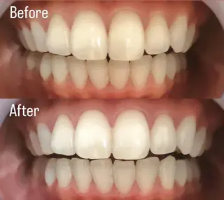 LBSホワイトニング 銀座店💎店長浦和のその他イメージ