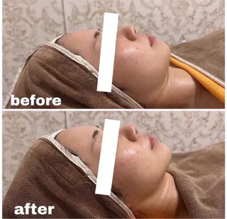 西区九条エステ MITUREIサロンのエステ・リラクイメージ