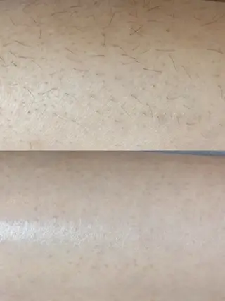 Hit. シュガーリング豊橋のエステ・リラクイメージ