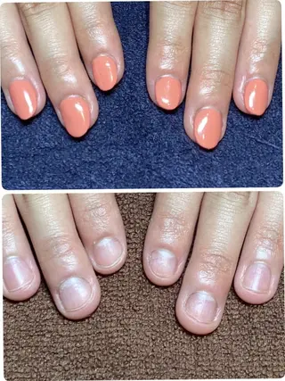 ネイル 深爪矯正/爪育成ケア manie nailのネイルデザイン