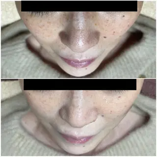 代表 MOMOの眉毛・アイブロウイメージ