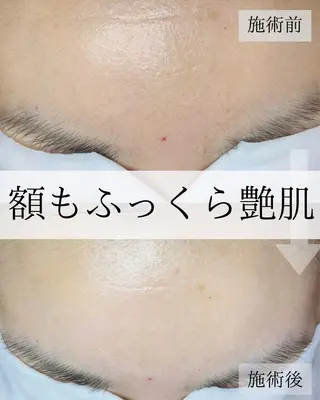 毛穴汚れ改善専門店/ 岸和田/リヒオルオルのエステ・リラクイメージ