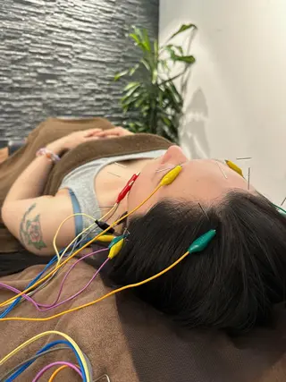 美容鍼灸整体サロンBeauJu所属・小顔矯/美容鍼/鍼灸 BeauJuのその他イメージ