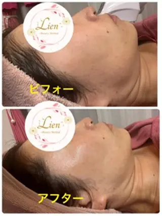 Lien オーナー 山口智嘉のエステ・リラクイメージ