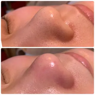 Organic&Detox salon Beloved所属・Beloved えなかのエステ・リラクイメージ