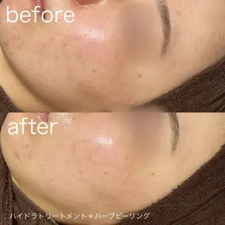 lulularico Yuのエステ・リラクイメージ