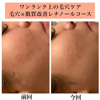 Bellesthe (ベルエステ)のエステ・リラクイメージ