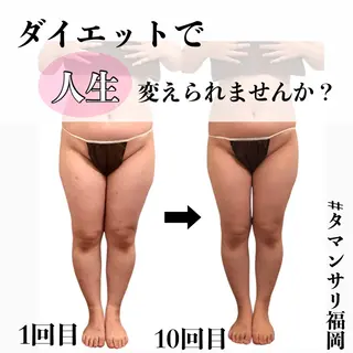 タマンサリ所属・タマンサリ 黒木のエステ・リラクイメージ