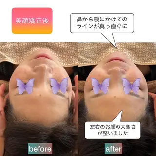 美ボディケアHacT所属・小顔を育てるサロン 小池智之/浅草橋のエステ・リラクイメージ