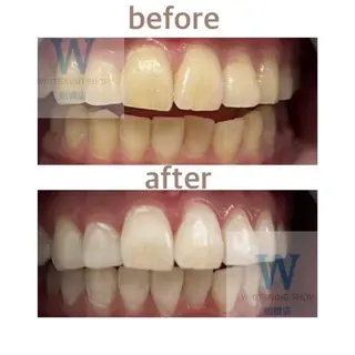 ホワイトニング ショップ船橋店のエステ・リラクイメージ