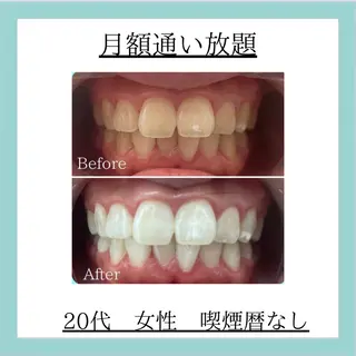 ホワイトニング専門店 WHITE天神店のエステ・リラクイメージ