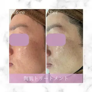 ミディアム カラー パーマ ヘアアレンジ メンズ キッズ ネイル マツエク・マツパ アイブロウ Amaryllis 🌹松本のエステ・リラクイメージ