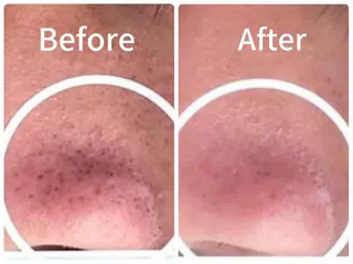 垣田 ジョアアンジェ京橋のエステ・リラクイメージ