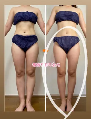 ショート カラー パーマ ヘアアレンジ メンズ キッズ ネイル マツエク・マツパ ‍痩身＆ボディ 結果出し🌟丹野のエステ・リラクイメージ