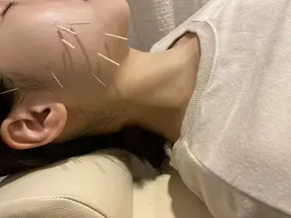 むくみたるみ専門☆ 美容鍼・小顔矯正のエステ・リラクイメージ