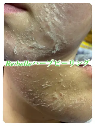 Dione八王子店所属・LUKE （ルーク）のエステ・リラクイメージ