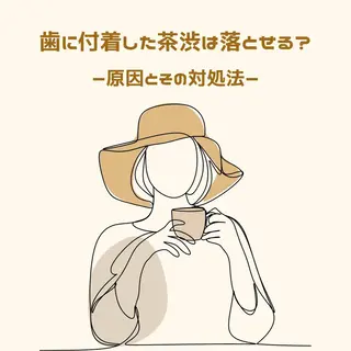 歯のホワイトニング HARU南浦和のその他イメージ