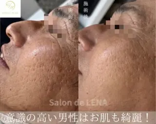 ハーブピーリング・毛穴ケア専門サロンSalon de LENA 栄店所属・ハーブピーリング専門 サロンドレナ　白藤のエステ・リラクイメージ