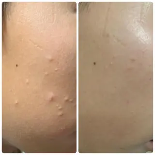 Luce所属・Luce Shokoのエステ・リラクイメージ