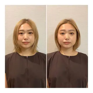 即小顔♥️美容鍼× ハーブピーリングのその他イメージ