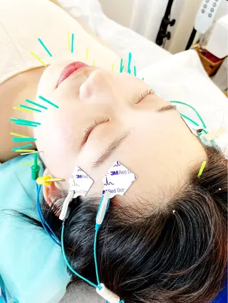 小顔美容鍼専門サロン 渋谷YZのエステ・リラクイメージ