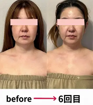 エラ張り・むくみ 小顔サロン（北谷）のエステ・リラクイメージ