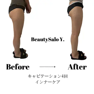 ダイエット専門店 Y.【ワイドット】のエステ・リラクイメージ
